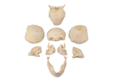 Lot 474 - A Disarticulated Human Skull