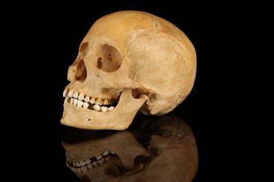 Lot 204 - A Medical Human Skull