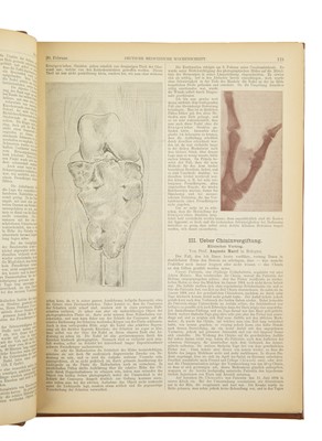 Lot 277 - Deutsche medicinische Wochenschrift, 1896, The first papers on the application of Röntgen or X rays in medicine