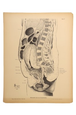 Lot 475 - Medicine - Schroeder, Karl Ludwig Ernst, 1886
