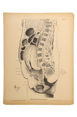 Lot 393 - Medicine - Schroeder, Karl Ludwig Ernst, 1886