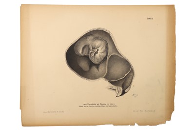 Lot 475 - Medicine - Schroeder, Karl Ludwig Ernst, 1886