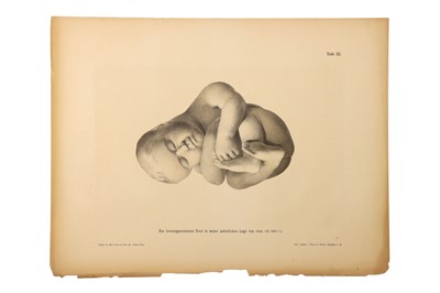 Lot 393 - Medicine - Schroeder, Karl Ludwig Ernst, 1886
