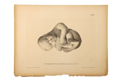 Lot 475 - Medicine - Schroeder, Karl Ludwig Ernst, 1886