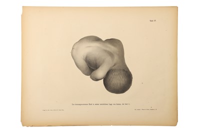 Lot 393 - Medicine - Schroeder, Karl Ludwig Ernst, 1886