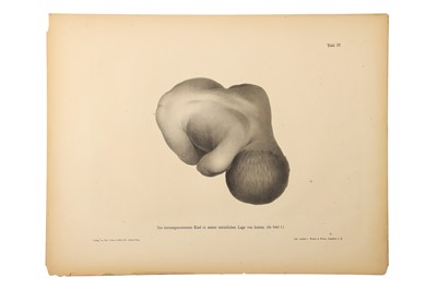 Lot 475 - Medicine - Schroeder, Karl Ludwig Ernst, 1886