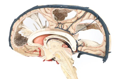 Lot 141 - DR LOUIS AUZOUX/ MAISON AUZOUX, An Anatomical Model of the Human Brain