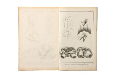 Lot 371 - Medicine – Surgical Technique and Instruments From Diderot and d’Alembet