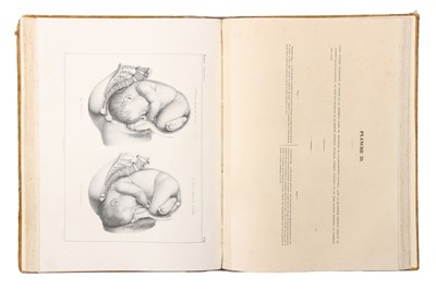 Lot 381 - Medicine – Traite Pratique Des Accouchemens, J Moreau,Atlas