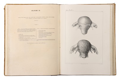 Lot 381 - Medicine – Traite Pratique Des Accouchemens, J Moreau,Atlas