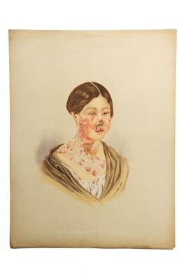 Lot 370 - Medicine - Sydenham Society, Atlas, Diseases of the skin