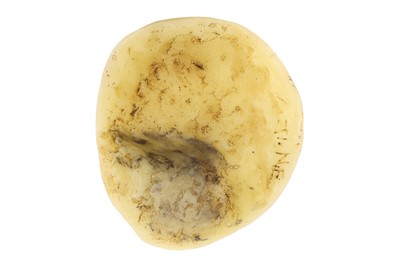 Lot 218 - Medical, A Wax Eye Epithesis