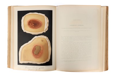 Lot 247 - The Museum of St Louis Hospital - Syphilis