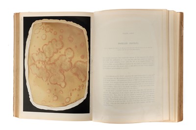 Lot 247 - The Museum of St Louis Hospital - Syphilis