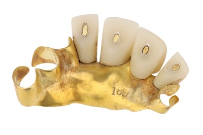 Lot 163 - A Gold & Porcelain Dental Bridge