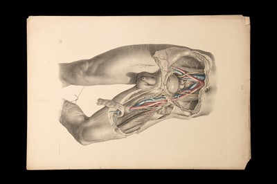 Lot 195 - Maclise, Joseph, Surgical Anatomy