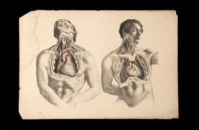 Lot 195 - Maclise, Joseph, Surgical Anatomy