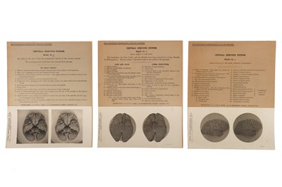 Lot 90 - Complete Set of The Edinburgh Stereoscopic Atlas of Anatomy