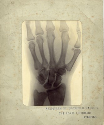 Lot 264 - PROSPER H MARSDEN Three Early X-Rays