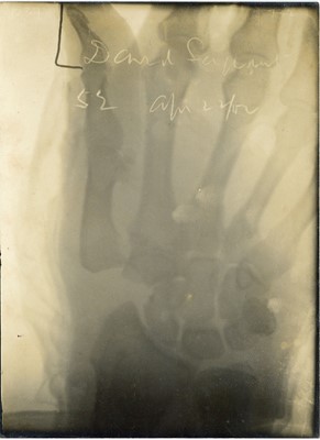Lot 264 - PROSPER H MARSDEN Three Early X-Rays