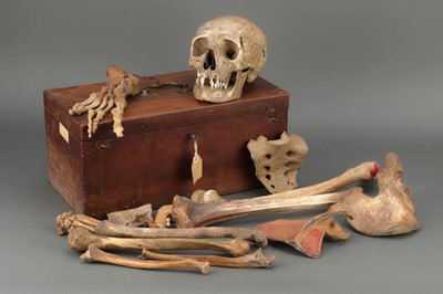 Lot 178 - Victorian Anatomical Human Skull & Part Skeleton