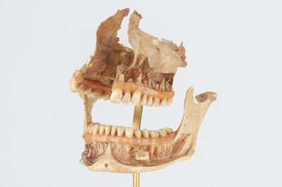 Lot 213 - 19th Century Human Didactic Jaw