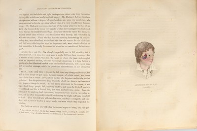 Lot 451 - John Bell, The Principles of Surgery, 1801