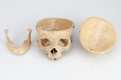 Lot 214 - 19th Century Human Skull & Part Skeleton