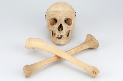 Lot 214 - 19th Century Human Skull & Part Skeleton