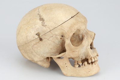Lot 214 - 19th Century Human Skull & Part Skeleton