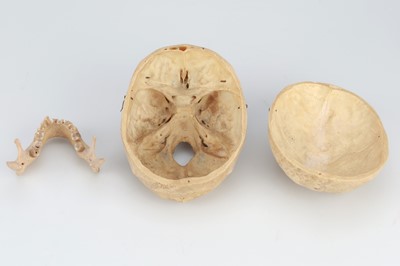 Lot 214 - 19th Century Human Skull & Part Skeleton