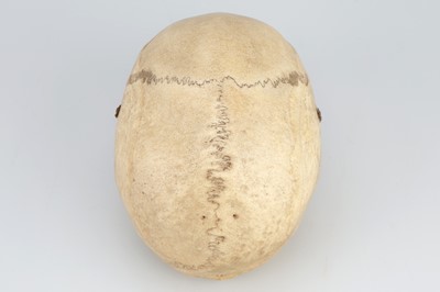 Lot 214 - 19th Century Human Skull & Part Skeleton