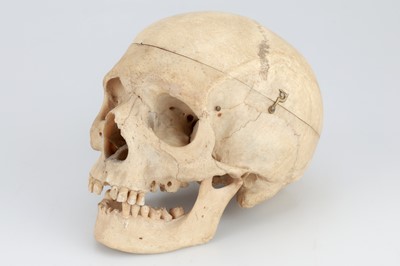 Lot 214 - 19th Century Human Skull & Part Skeleton