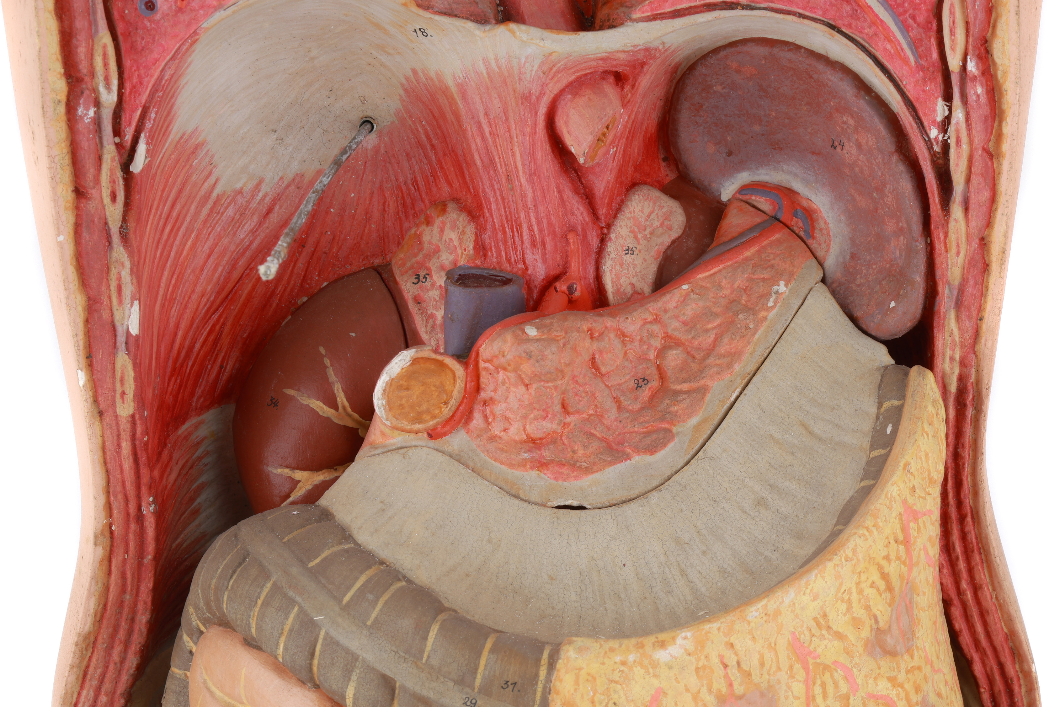 Lot 295 - Large Adam Rouilly Anatomical Model,