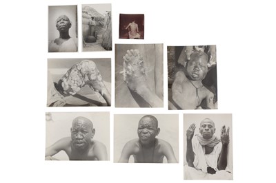 Lot 512 - Collection of Mcarbre Leprosy & Medical Photographs