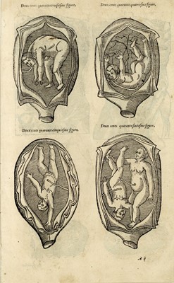 Lot 81 - Medical Interest -Three Early Copper Engravings
