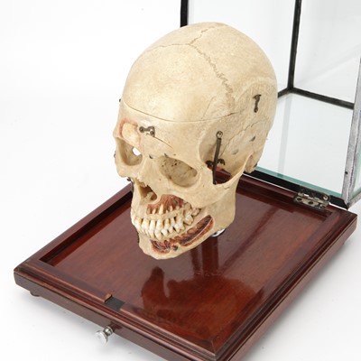 Lot 100 - A Dissected Human Skull