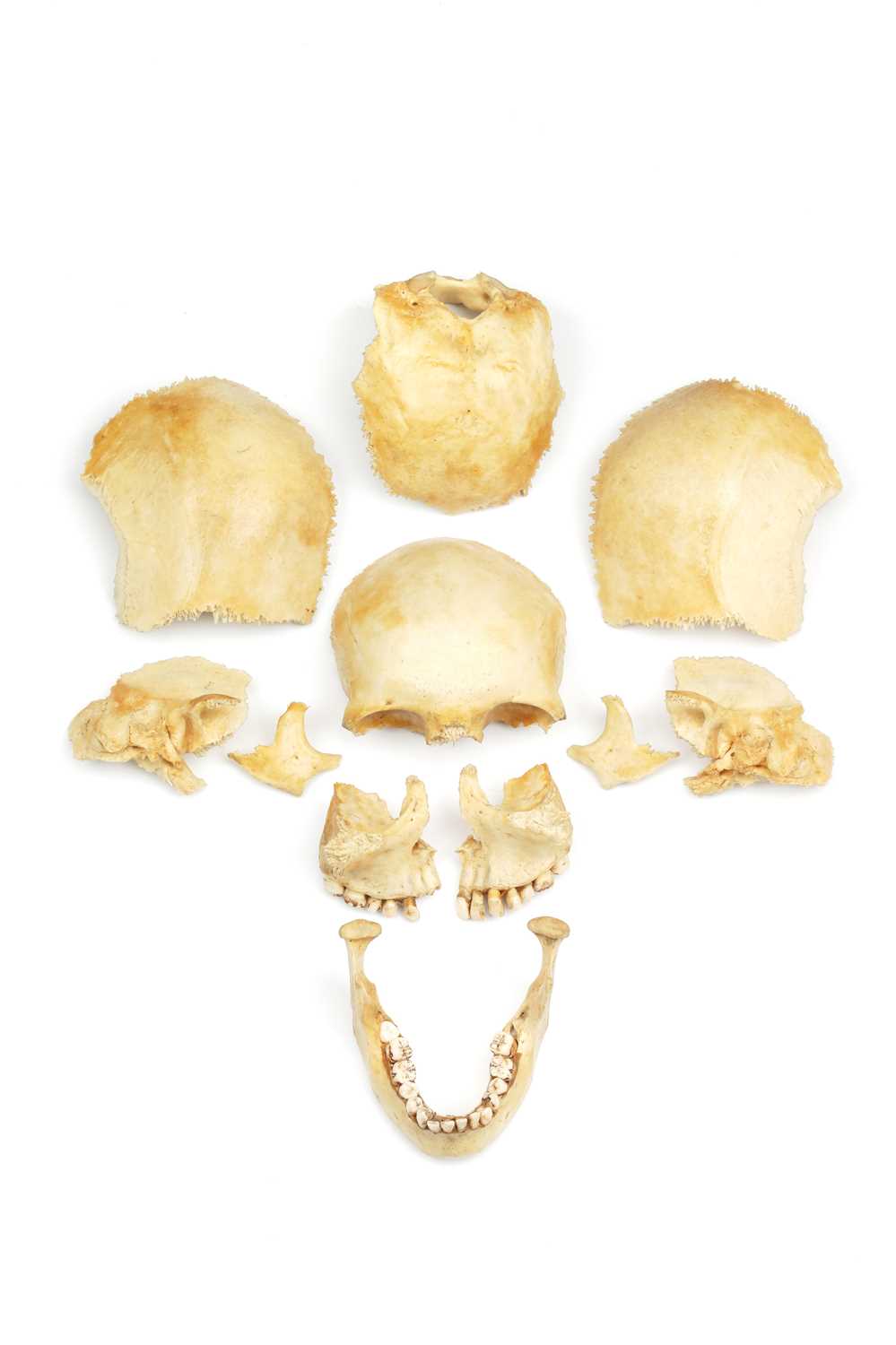 Lot 468 - Medical Students Disarticulated Human Skull