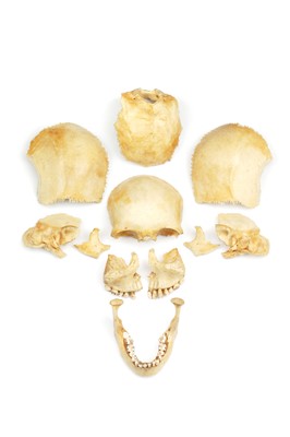 Lot 468 - Medical Students Disarticulated Human Skull